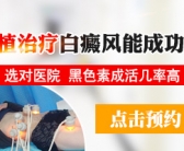 脸上长白癜风外用什么药好”