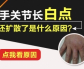 手背长的小白斑是什么是缺什么维生素吗”