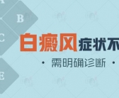 白癜风照308激光一周要几次”