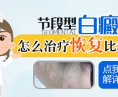 手背长个白斑会是什么皮肤病