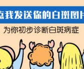手上有小块白斑图片会是什么皮肤病”