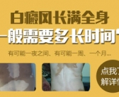 手上长了小白斑怎么能治好