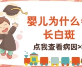 美国308激光治疗白癜风一周照射几次”
