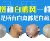 手背长的小白斑是什么怎么才能去除