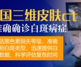 手上长个白斑需要用药吗