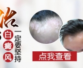手上头上起小白斑怎么处理