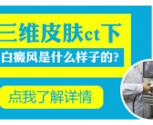 黑色素种植对白癜风有效果吗”