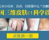 手上的白斑是什么是不是缺少微量元素