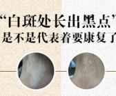 手上起了白斑怎么处理”