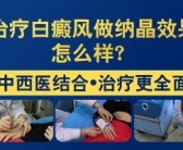 手上长了好多白斑怎么回事