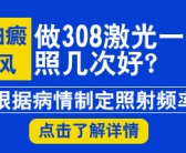 手上白癜风照射308激光多久做一次合适”