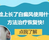 小孩脸上皮肤比其他地方都要白怎么回事”