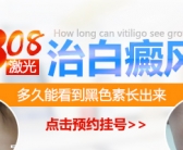 肢端型白癜风适合哪种方法治疗”