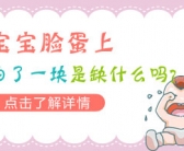 白癜风种植黑色素成功几率多大”