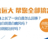 手上的小白斑图片要怎么才能祛除”