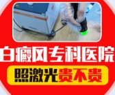 手上早期白癜风治好的希望大不大”