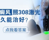 脸上长白癜风植皮好还是照光好”