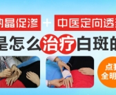 目前治疗白癜风用什么药治好”