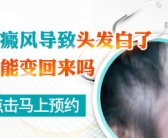 白癜风早期黄豆大怎么治疗才能真的治好”