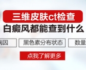 手上长了好多白斑是皮肤病吗