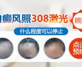308准分子激光白癜风要多少次”