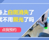 手上白癜风种植黑色素有治好的吗”