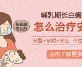 手上白癜风照射308激光一周照射多少次”