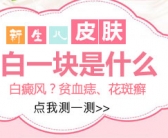 女性得白癜风做308治疗几天做一次”