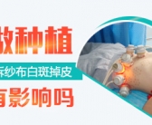 小孩腿上大面积白癜风能种植黑色素吗”