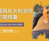 手上白斑怎么办怎么才能去除”