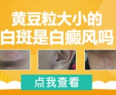 手上长小白斑图片要怎么才能祛除