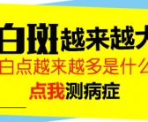 白癜风刚发病没多久该怎么治”