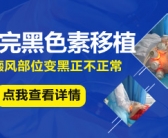 手上的小白斑需要用药吗”