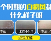 手背头上起小白斑怎么回事”