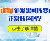 小孩手上身上有白块图片需要用药吗”