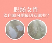 白癜风面积很小选择哪个方法效果才好”