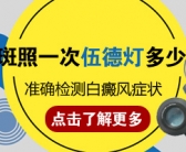 手上长了好多白斑是缺什么维生素吗