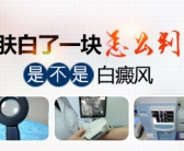 手背为什么有白斑是缺什么维生素吗