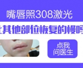 一小块白癜风才能真的治好”