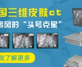 小孩手上有小白斑图片怎么能治好”