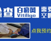 种植黑色素白癜风康复的概率多大”