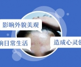 白癜风不是很严重怎么治见效快”