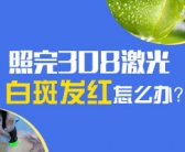 手腕遗传白癜风如何治不会复发”