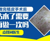 大片白癜风选择哪个方法比较好”