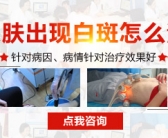 手上长了好多白斑需要做什么检查”