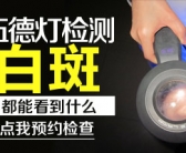 手上白癜风早期治好的多不多”