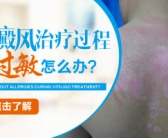 生下来手上有小白斑怎么回事