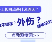 手上出小白斑是什么原因