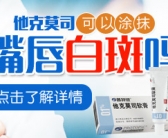 手上长了好多小白斑需要用药吗”