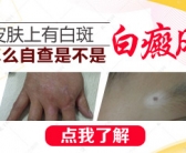 小孩脸部上出现一些白斑是白癜风吗”